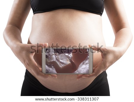 Echography of a baby on a phone Royalty-Free Stock Photo #338311307