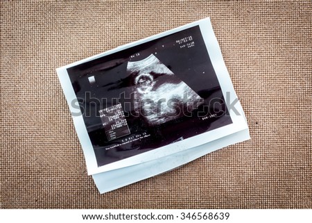 Photo of an ultrasound sonogram of an unborn baby Royalty-Free Stock Photo #346568639