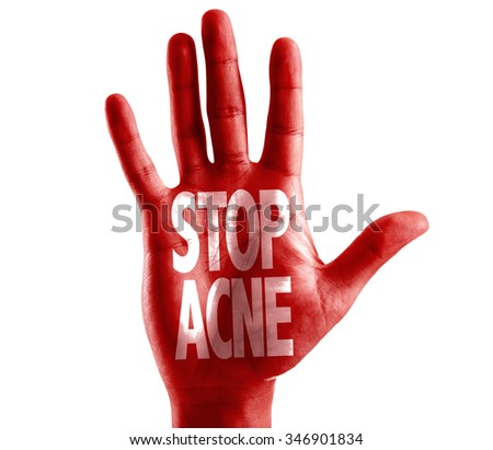 Stop Acne written on hand isolated on white background