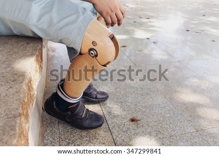 prosthetic leg, The poor amputee with his old prosthesis using Royalty-Free Stock Photo #347299841