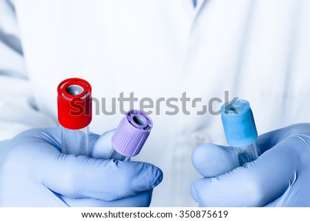 Test tubes in hand, palm, fingers for  science, scientific, chemical, chemistry research or experiment. Lab medical glass equipment, medicine, biology or biotechnology liquid. Scientist.