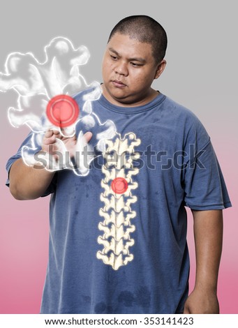 Fat guy Show Xrays of human spine and try to look closer.