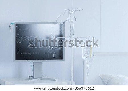 Horizontal view of professional electrocardiogram in a hospital room