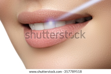 Perfect smile after bleaching. Dental care and whitening teeth. Laser teeth whitening  Royalty-Free Stock Photo #357789518