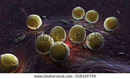 Streptococcus pyogenes infection Royalty-Free Stock Photo #358169744