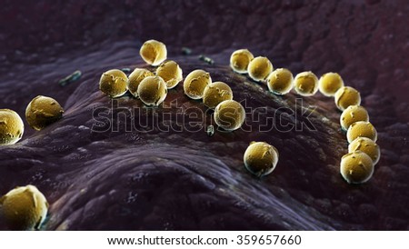 Streptococcus pyogenes infection Royalty-Free Stock Photo #359657660
