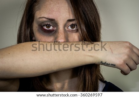 Sad beaten up girl with wounds on the face looking at the camera with deep look - caucasian people - concept about violence against women Royalty-Free Stock Photo #360269597