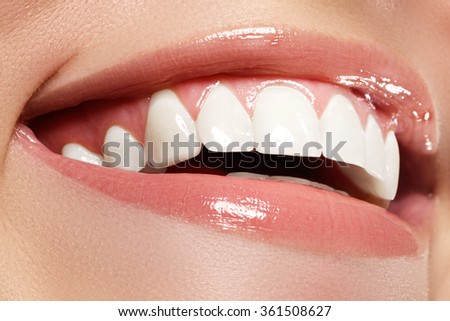 Perfect smile before and after bleaching. Dental care and whitening teeth Royalty-Free Stock Photo #361508627