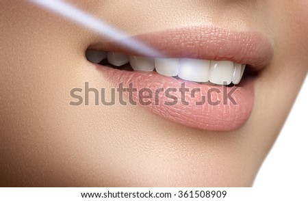 Perfect smile after bleaching. Dental care and whitening teeth. Laser teeth whitening Royalty-Free Stock Photo #361508909