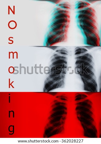 image x-ray picture of lungs in three different styles: a black and white, three-dimensional graphics, and on a red background with the words "no smoking"