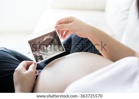 Pregnant woman with ultrasound scan picture  