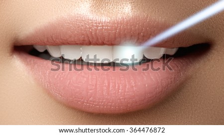 Perfect smile after bleaching. Dental care and whitening teeth. Laser teeth whitening Royalty-Free Stock Photo #364476872