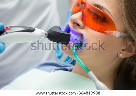 Tooth filling ultraviolet lamp Royalty-Free Stock Photo #364819988