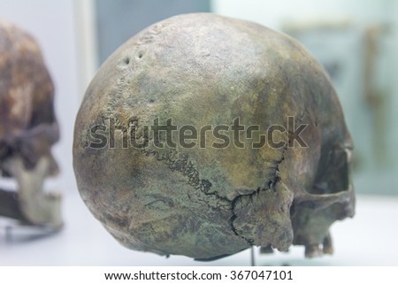 Back of a human skull