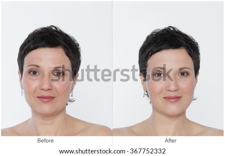 Middle aged Woman with and without bags under the eyes, aging singes, wrinkles, blemishes. Before and after cosmetic or plastic procedure, anti-age therapy, blepharoplasty. Royalty-Free Stock Photo #367752332
