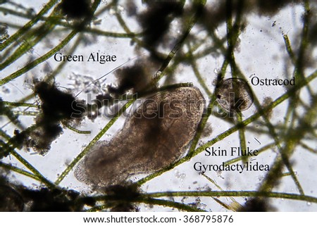 Microscopic life Skin Fluke aka Gyrodactylidea from a Fresh Water Duck Pond seen through a Microscope at 100 times its normal size. Photo taken with a DSLR Camera and Microscope adaptor.