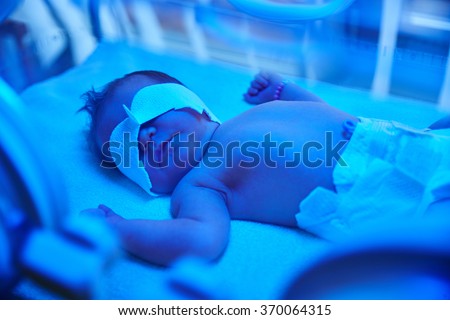 Newborn photo light therapy Royalty-Free Stock Photo #370064315