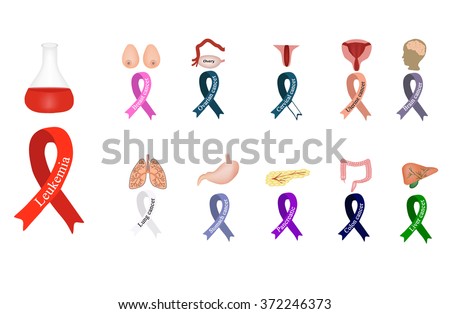 Cancer Ribbon. Set of ribbons of different colors against cancer. World Cancer Day. Childhood Cancer Day. Breast, ovary, cervix, uterus, brain, lungs, stomach, pancreas, intestines, colon, liver. 