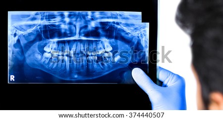 Dentist holding & viewing full mouth X-ray of a patient isolated in white background