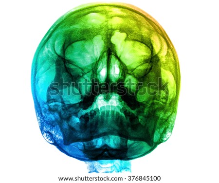 x-ray image of skull human