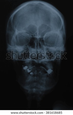 X-ray of the teeth, jaws and skull.