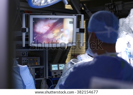 Surgical operation robot. Medical operation involving robot. Robotic Surgery. Manipulators performing surgery on humans. Royalty-Free Stock Photo #382154677