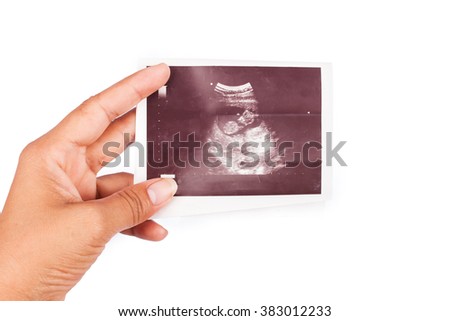 hand mom hold ultrasound baby 