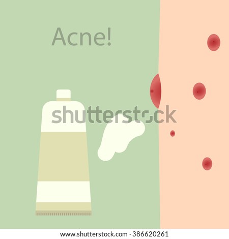 Ointment for acne. cleansing foam. work for healthy skin. beauty face. Vector illustration