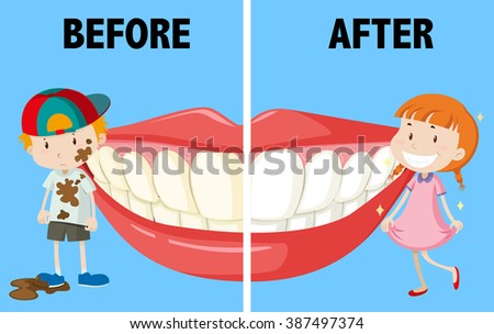 Opposite words before and after illustration