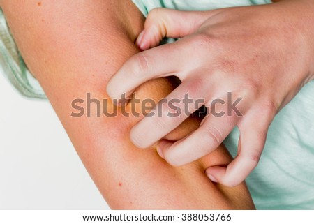 woman itchy skin Royalty-Free Stock Photo #388053766