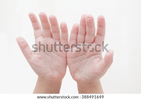 The photo palm child of three years , which wrinkled and shriveled due to the long stay in the water and swim , pink palm on a white background. Royalty-Free Stock Photo #388491649