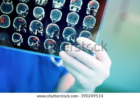 Doctor attentively examines the MRI scan of the patient. Royalty-Free Stock Photo #390249514