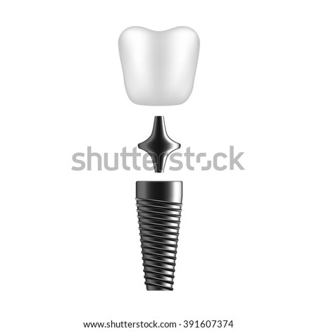 Dental implant in disassembled form in parts. Tooth crown, pin. Isolated on white background.