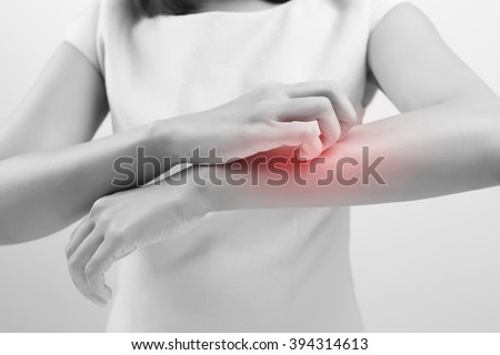 Woman scratch the itch with hand, Arm, itching, Concept with Healthcare And Medicine.
