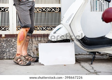 a man fell from the motorbike Royalty-Free Stock Photo #398667226