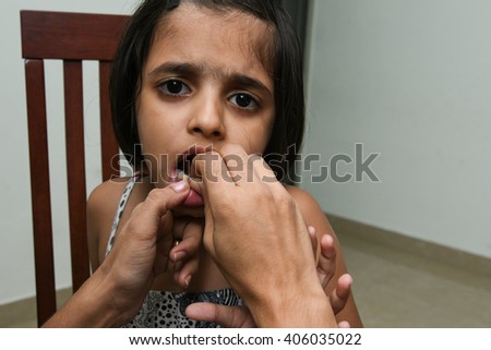 Little / small Indian girl / child / kid, weeping / crying pain showing lost deciduous / broken tooth /  first baby milk / temporary teeth, India. Painful, child caries. Dental medicine, healthcare. 