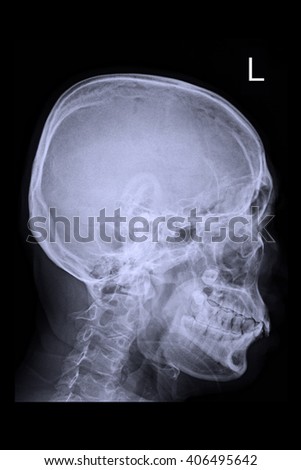 human skull 