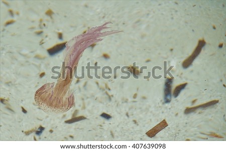 jellyfish in the clear sea water