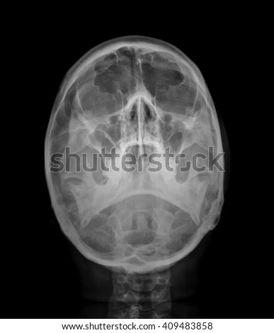 skull x-rays image sagital plane