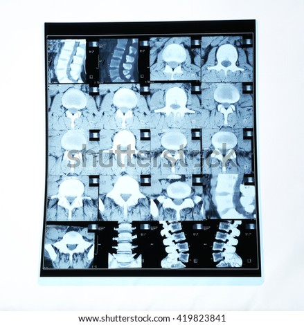 Collage of x-rays isolated on white