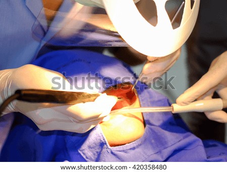 dental scaling 