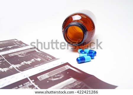 Ultrasound pictures,medicine,bottle, isolated on white background.