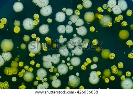 Different color, size and type colonies of bacteria from public hall air on a petri dish (agar plate) isolated on black background. Trypticase soy agar (TSA) used. Focus on full depth. Royalty-Free Stock Photo #426036058