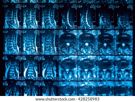 Medical equipment. MRI picture. Background