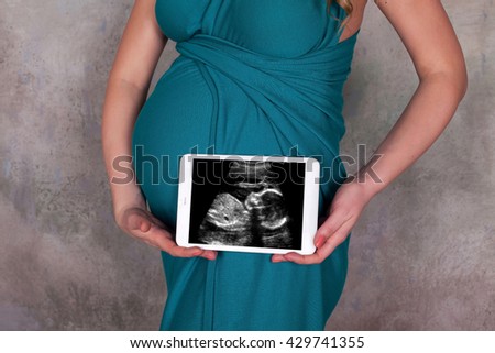 Belly of a pregnant woman in blue dress holding ultrasound picture