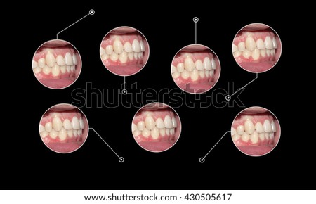 teeth captions infographic illustration