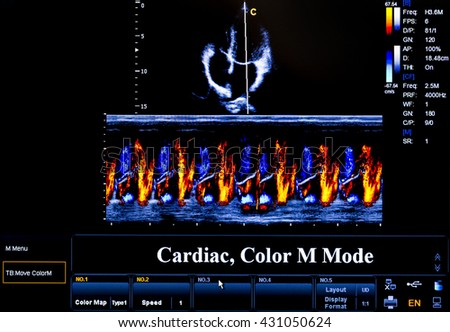 Modern echocardiography (ultrasound) machine monitor. Colour image. New hospitl equipment. Cardiac, Colour M Mode.