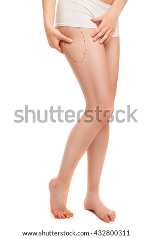 Close-up of woman in panties with liposuction circle on leg