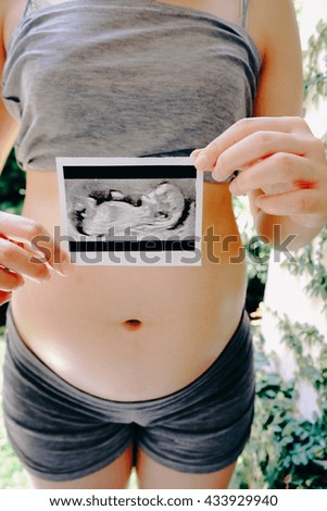 Pregnant Woman Holding Ultrasound Scan Photo