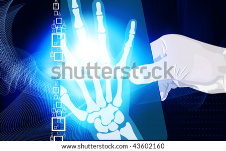 Illustration of a hand holding a X-ray film	